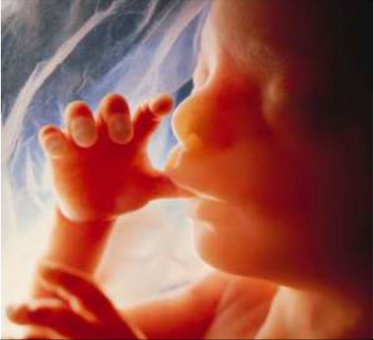 The unborn child at 18 weeks gestation. 600 babies are aborted daily in the UK - some, up to and even during birth, with the full force of the British law.